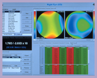 Excimer laser shot.jpg