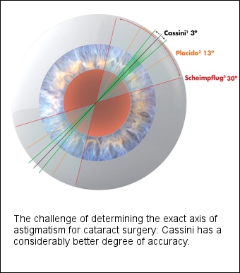 Cornea