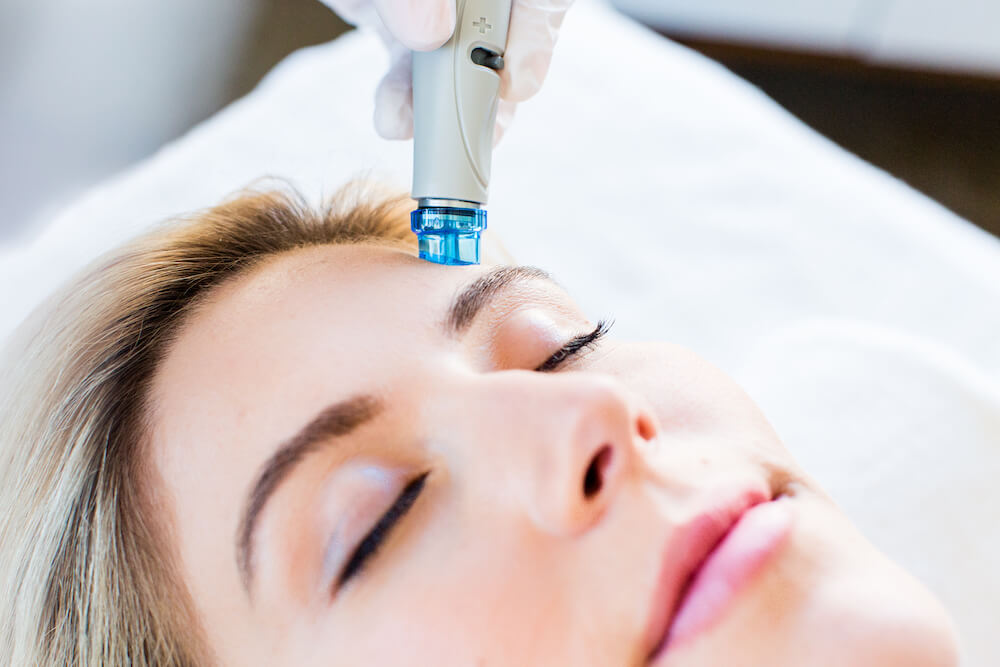 HydraFacial Procedure In Progress