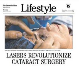 Laser Cataract Surgery Article