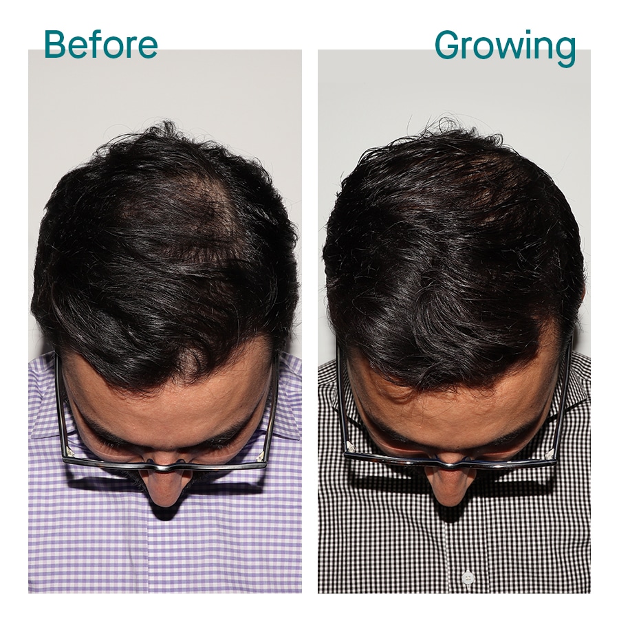 MALE Before Growing 10-months