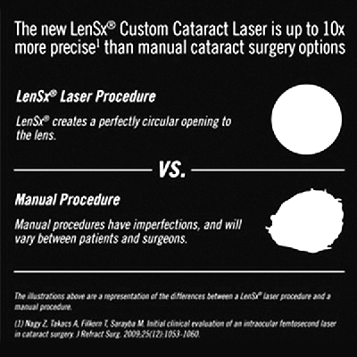 LenSx vs. manual surgery comparison diagram