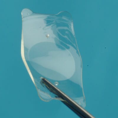 Visian ICL implantable collamer lens